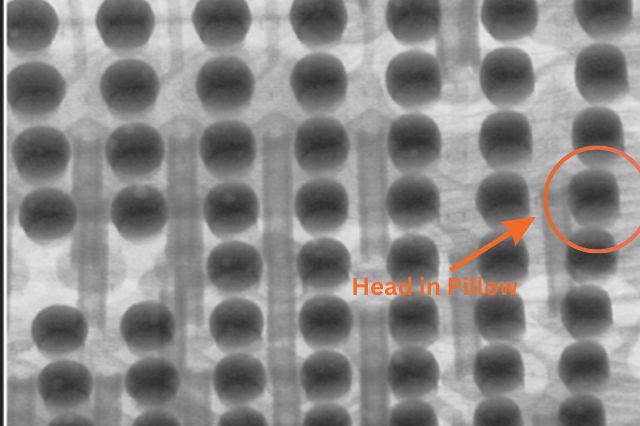 xray image showing an real example of a head in pillow defect